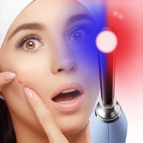 The Luminance RED - ClearBeam Acne Device